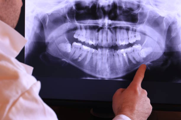 Best Pediatric Emergency Dentist in Osceola, IN