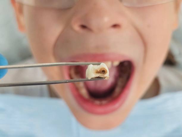Best Emergency Dentist for Special Needs Patients in Osceola, IN